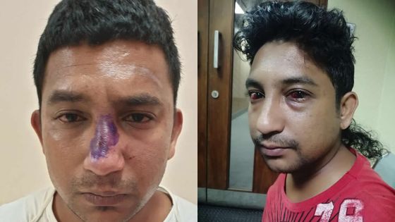 Au poste de police de Trou Fanfaron : les jumeaux Chantoiseau allèguent avoir été victimes de brutalité policière 