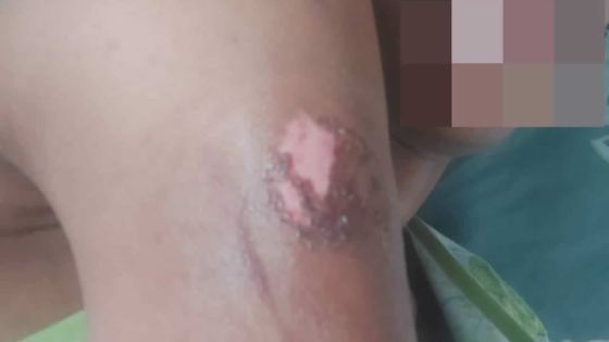 Violence domestique : les deux concubins portent plainte 