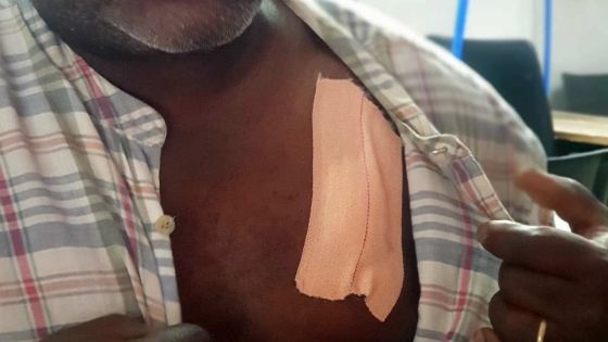 Il dénonce la prostitution dans la localité : un père de famille agressé avec un tire-bouchon à Cassis