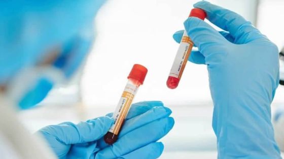 Séquençage : l’appareil opérationnel en avril