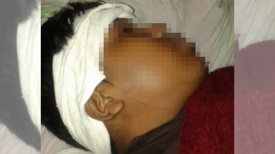 ‘Attempt at murder’ à l’école : un adolescent étranglé avec un câble électrique