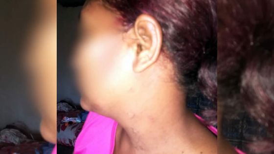 Sheila frappée par son mari pour avoir refusé un rapport sexuel