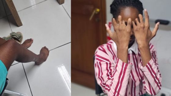 Née avec une malformation aux mains et au pied droit : Abigaelle, 17 ans, privée  de sa pension d’invalidité