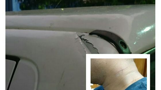 Port-Louis : un assistant inspecteur de la CWA agressé par un abonné armé de sabre 