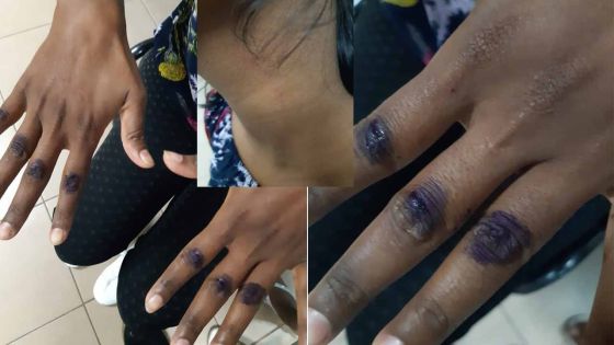 Dans un supermarché : une mère et ses deux enfants agressés par une caissière