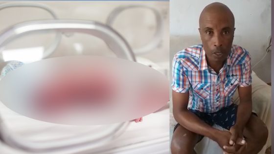 Le bébé atteint de malformation nécessitant une intervention en Inde décède 