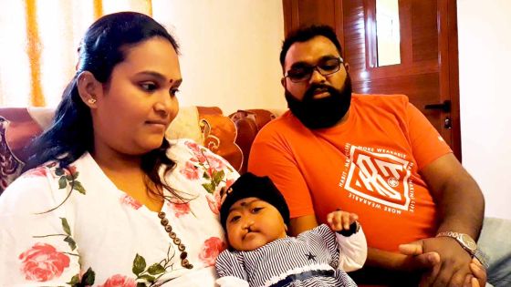 Bec-de-lièvre : Medhinee ou le combat de celle qui veut aider à corriger cette malformation 