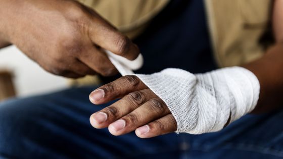 Les gestes de secours à adopter en cas de brûlures à la maison 