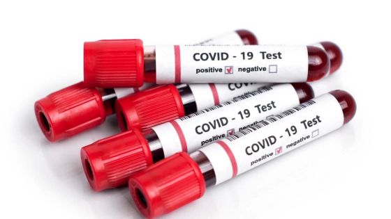 Covid-19 : 19 nouveaux cas ce mardi après-midi