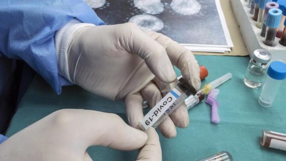 Covid-19 : Les trois nouveaux cas positifs liés au 325ème patient 