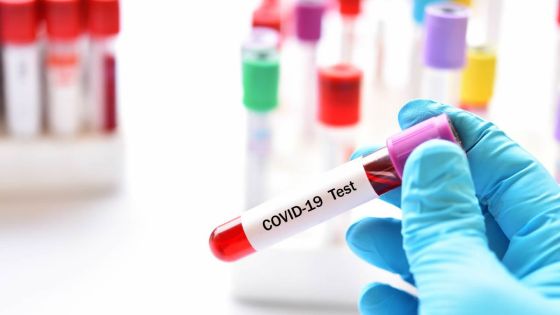 COVID-19 : baisse du nombre de nouveaux cas malgré la présence du sous-variant BF.7 