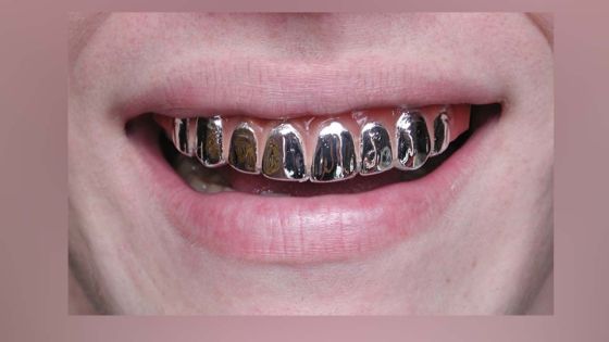 Dents en platine des trafiquants de drogue : l'Icac lance l'opération «rass ledan» 