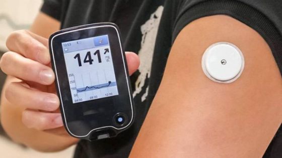 Diabète de type 1 : pas de distribution de pompes à insuline pour le moment