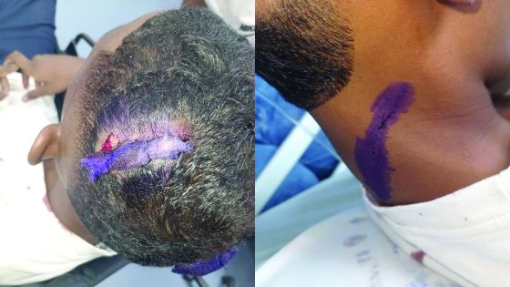 Food and Fun Day : un élève agressé à coups de sabre dans une chambre d’horreur à l’école