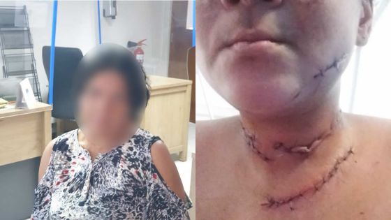 Un toxicomane sème la terreur : après avoir défiguré sa sœur, il menace sa mère de mort