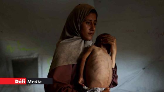 La catastrophe à Gaza rappelle les famines en Ethiopie et au Biafra, selon l'ONU