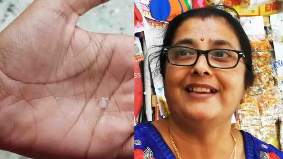 Grêle à Sébastopol : du jamais vu pour les habitants