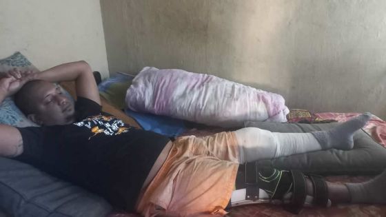 Suite à un terrible accident de moto : le jour où la vie d’Hugo a basculé à jamais