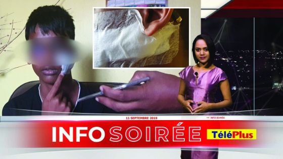 Agressé au cutter par un camarade : 20 points de suture au visage pour un collégien