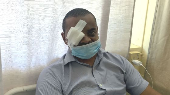 Il risque de perdre l’usage d’un oeil - le policier Jimmy Baptiste : «San mark mwa a vi, mais mo pou surmonte»