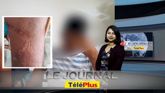 Le JT - Accident durant un rallye - sa vie bascule à 16 ans