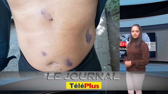 Le JT – Il se bat pour sa vie, Hasmat Jameer a sauvé celle de son père en risquant la sienne