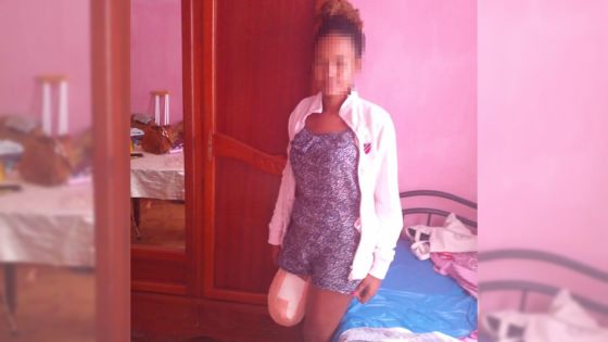 Le jour où sa vie a basculé : le témoignage de Caroline, une mère célibataire de 24 ans, amputée d’une jambe