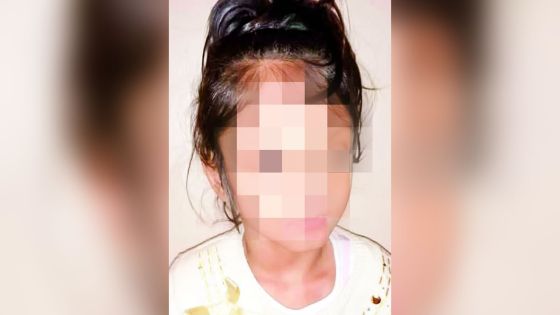 Elle souffre de paralysie cérébrale : l’enfance volée de Chimera, 6 ans