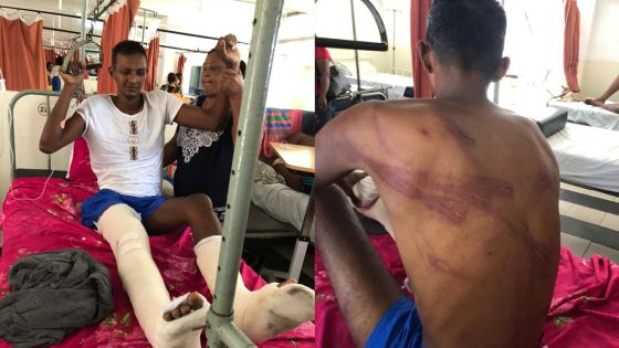 Un jeune homme allègue avoir été victime de brutalités policières