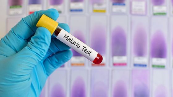 Après son retour du Congo : un Mauricien de 52 ans décède de la malaria 