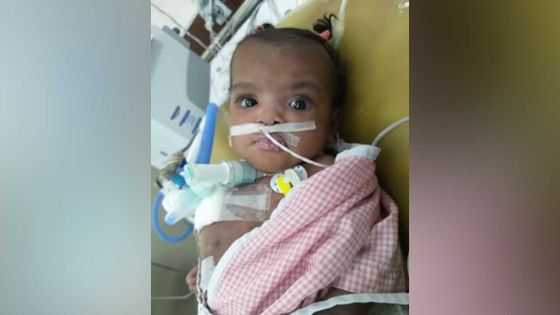 Bébés siamois : l’état de Marie Cléanne s’améliore