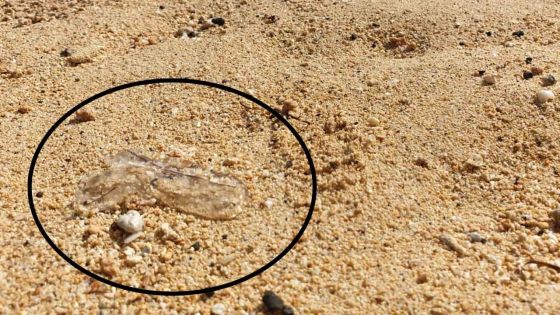 Alerte aux méduses à La Preneuse
