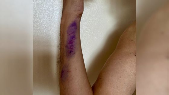 Deux molosses attaquent un retraité et sa fille