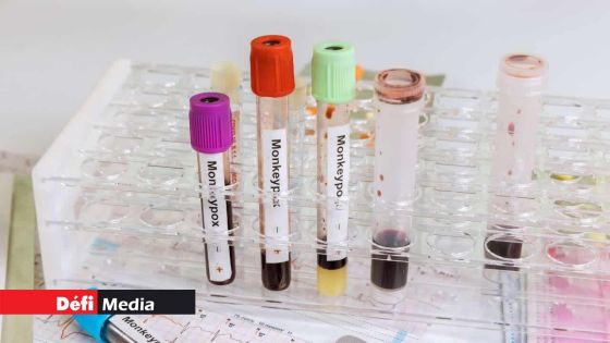 Cuba: un touriste italien meurt de la variole du singe, premier cas dans le pays