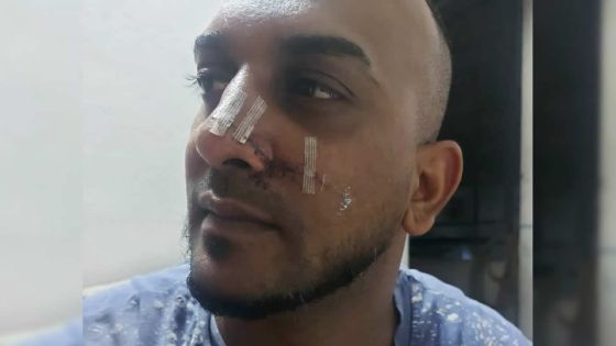 Rixe sanglante à Vallée-des-Prêtres : un père de famille menacé et tabassé dans sa voiture