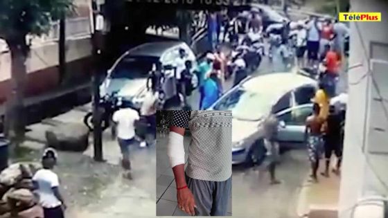 Une bande de motards s’en prend à un conducteur : battu à coups de casques alors qu’il se rendait à une prière 