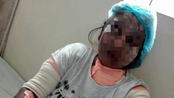 À Rivière-du-Rempart : un couple de retraités prisonnier des flammes