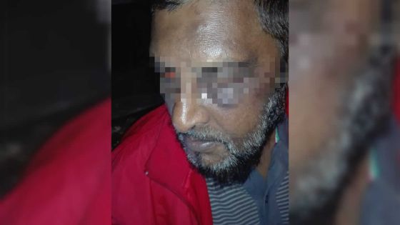 Au cours d’une fête d’anniversaire : un père tabassé en allant récupérer ses deux filles mineures