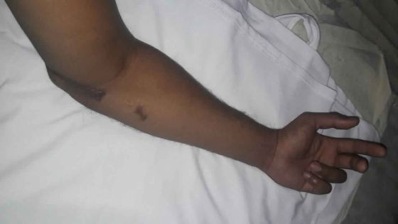 Il doit se rendre d’urgence à l’île de La Réunion pour recouvrer l’usage de sa main
