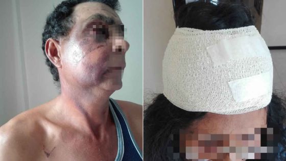 Victime de vols avec violence : un vigile et une boutiquière violemment agressés