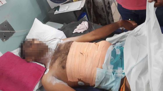 Dispute sanglante à Pointe-aux-Piments : un chauffeur étripé avec le tesson d’une bouteille