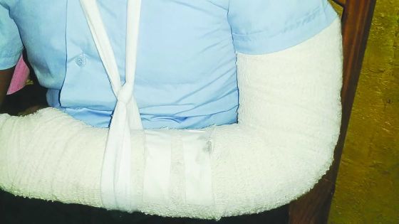 À Baie-du-Tombeau : elle se fait tabasser par ses camarades à l’école