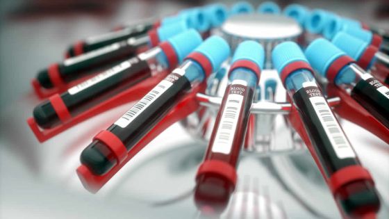 Metropolis : offre promotionnelle sur des examens médicaux