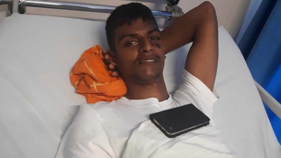 Une femme de 65 ans percutée par une moto : son fils se jette dans le vide pour lui porter secours 