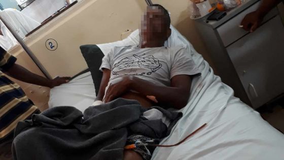 Accident de la route : un motocycliste amputé du pied gauche après une collision