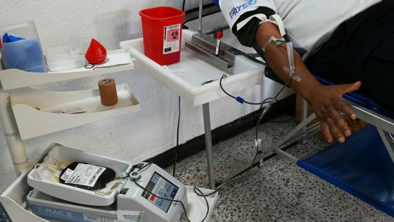 Covid-19: problèmes cérébraux possibles même dans des formes bénignes