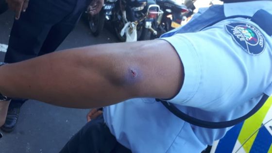 Deux policiers mordus et séquestrés à Quatre-Bornes : quatre suspects courent toujours