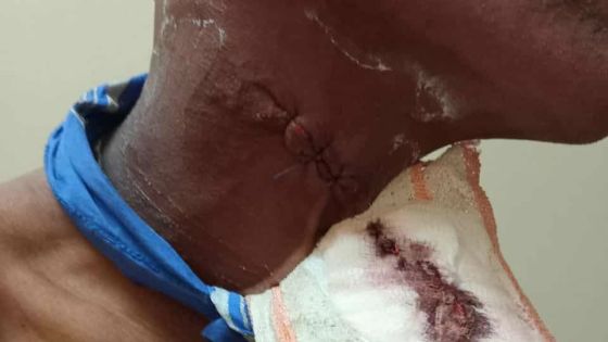 Déploiement de la SMF et de la CERT - prison de Melrose : entre intervention musclée et accusations de brutalités 