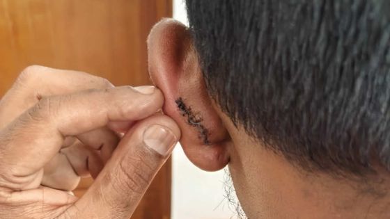 À Clairfonds : un plombier déclare avoir été agressé par un policier en pleine rue