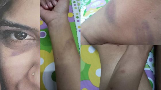 Violence conjugale, chantage, photos intimes : malgré un Protection Order, elle est menacée chaque jour 